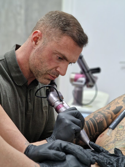 Laser Tattoo Valencia Valencia