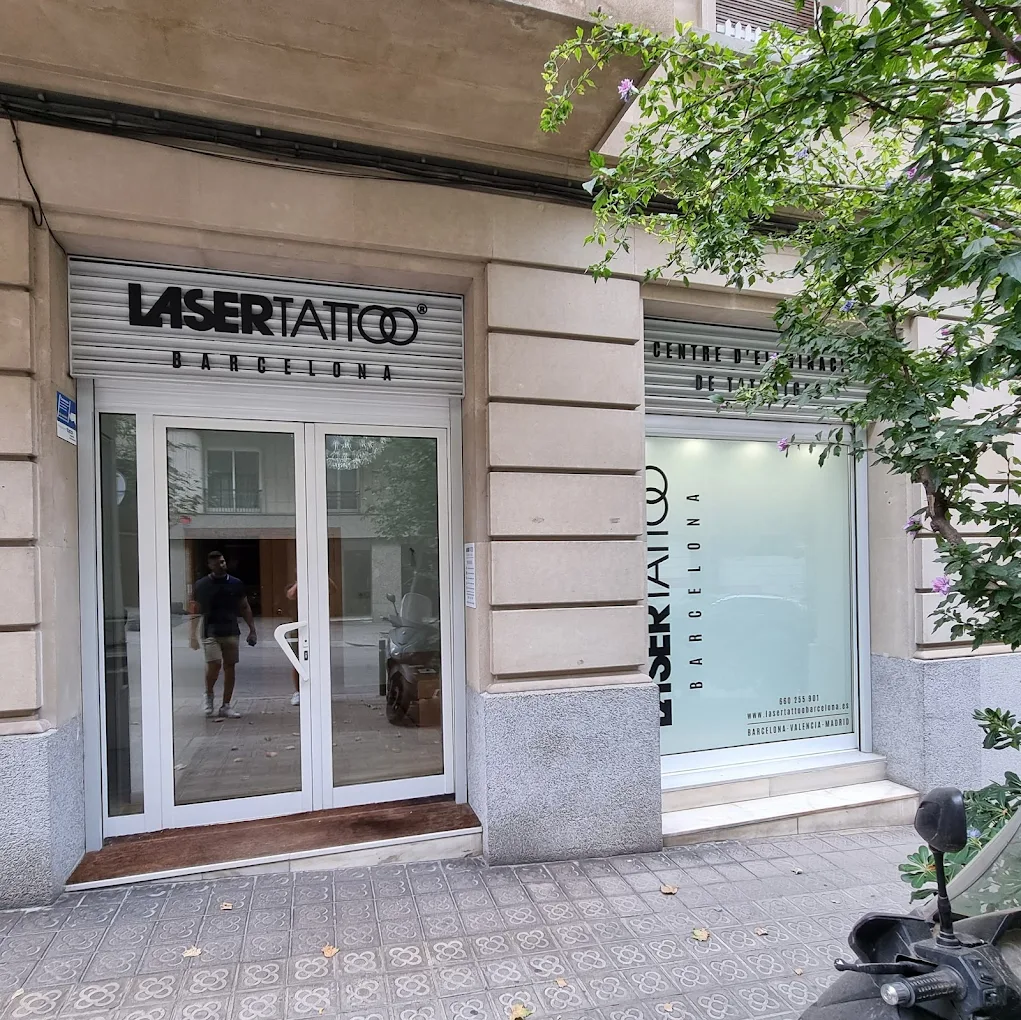Laser Tattoo Barcelona